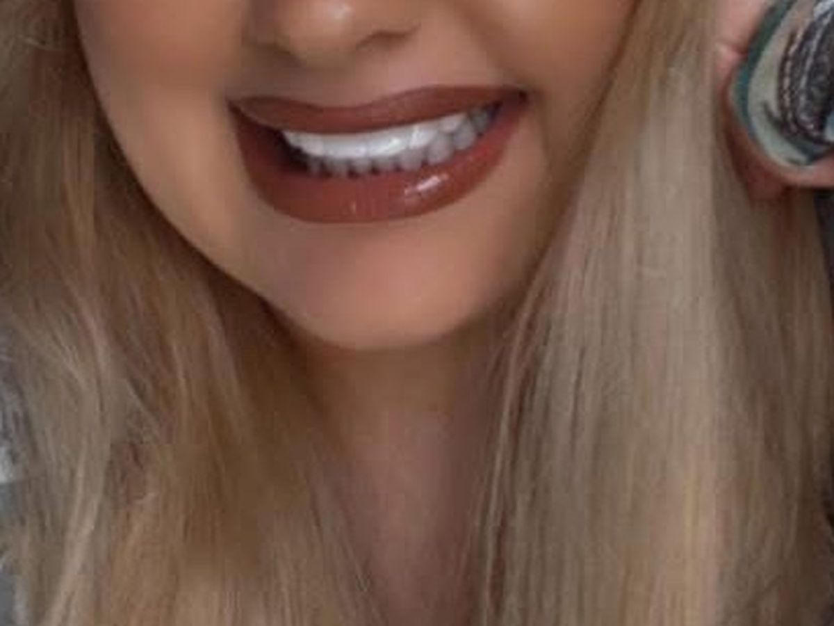 Help Restore My Smile After Accident campaign photo, 1 of 6