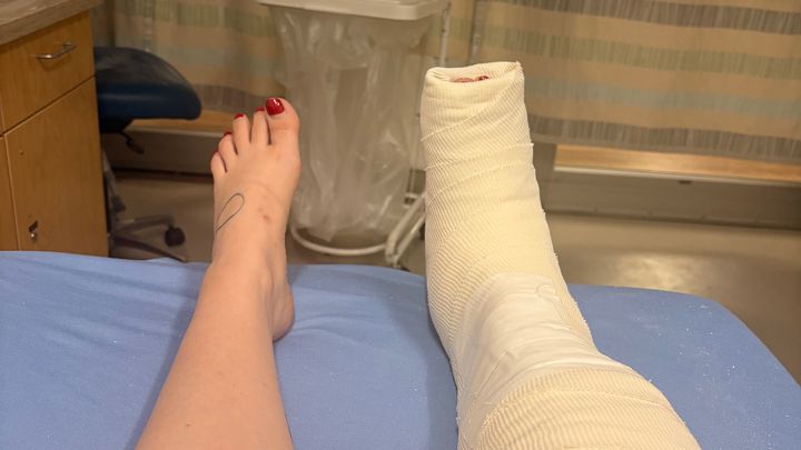 Help Cover Bills After My Ankle Injury campaign photo, 1 of 6