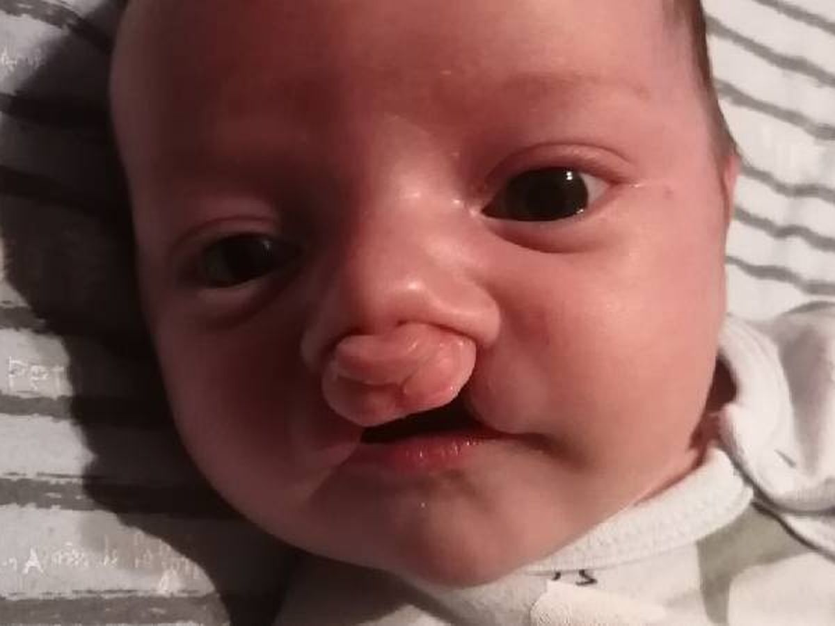 Fundraiser by Mabryna Theriault : Help Nahel get his forever smile