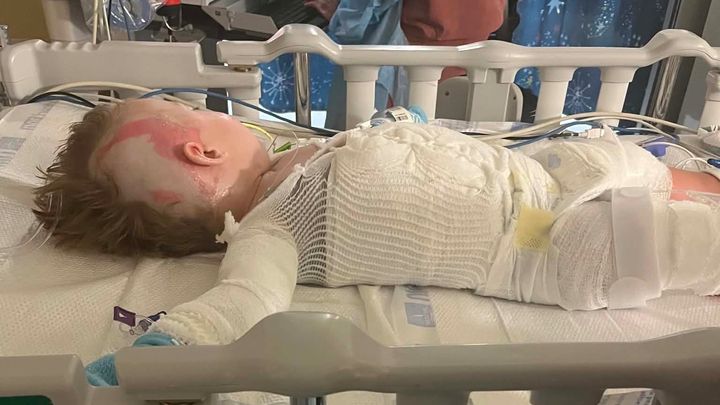 Help My Nephew Recover from Severe Burns campaign photo, 1 of 3