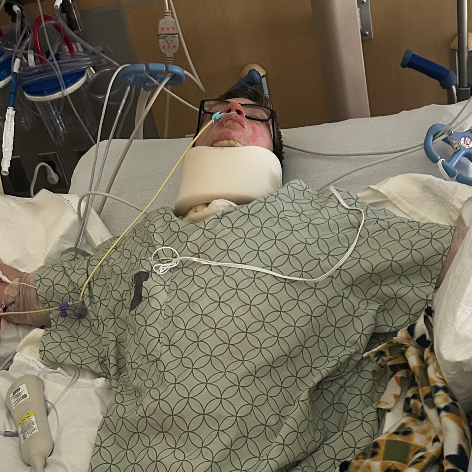 Support for Burn Recovery and Family Needs