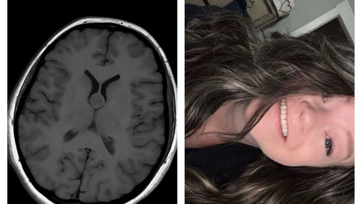 Help Shelbie with Medical Bills and Recovery campaign photo, 1 of 3