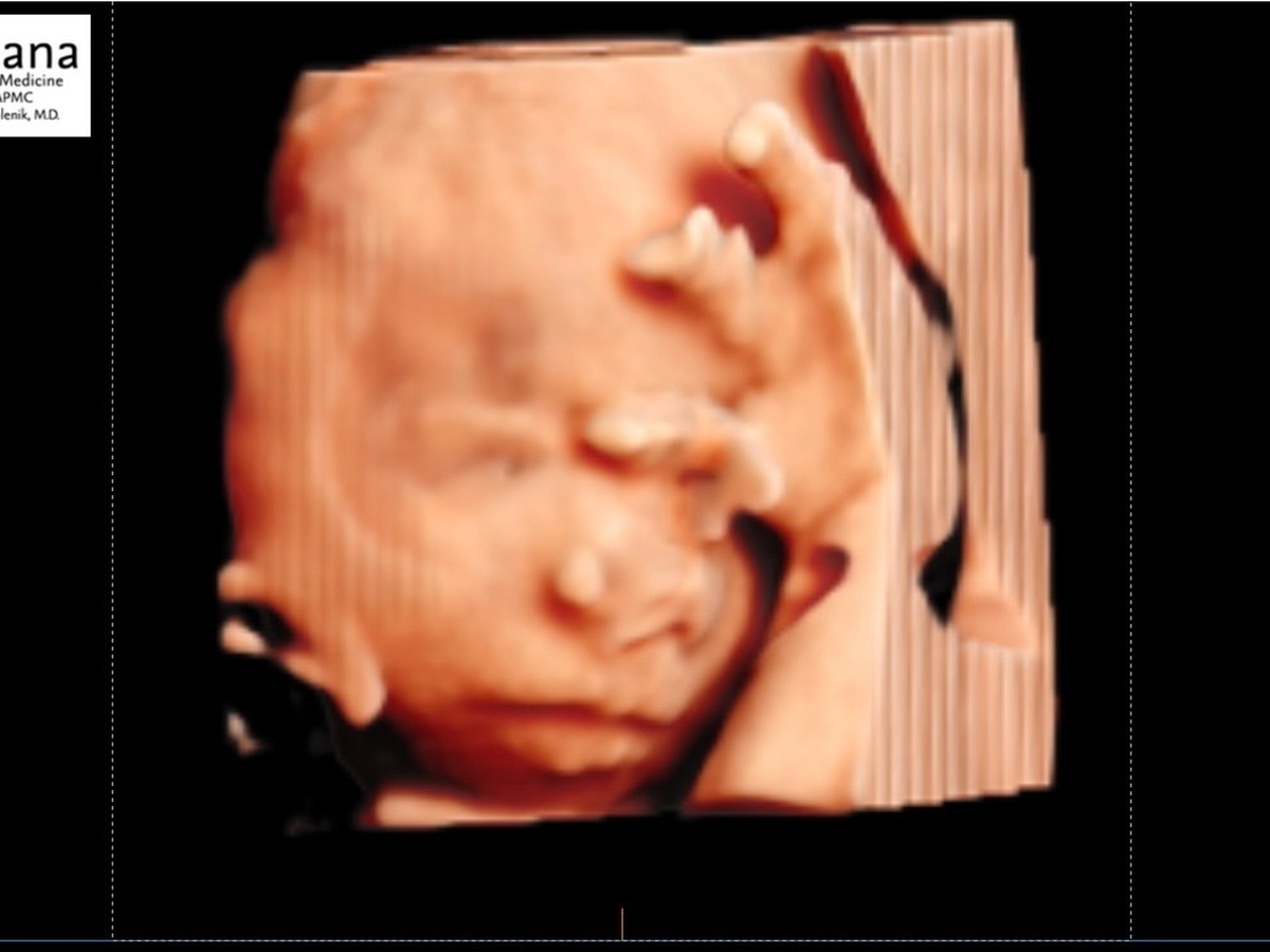 Fundraiser’s main image