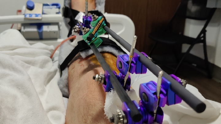 Fundraiser by amber jones : Support Scott's Recovery After Heroic Rescue