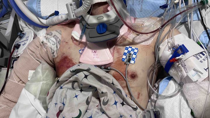 Help CJ Recover After Accident campaign photo, 1 of 7