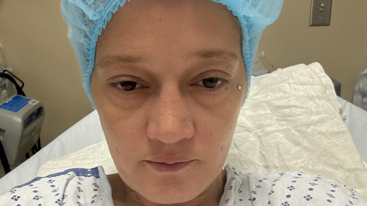 Support Recovery from Diverticulitis Surgery campaign photo, 1 of 8