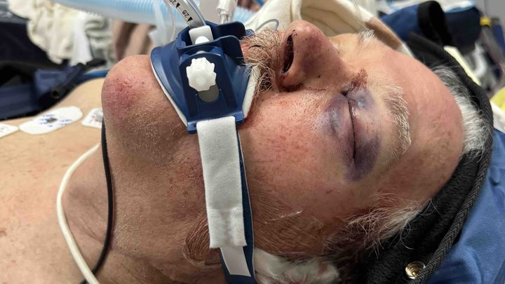 Aid Rick's Journey After Traumatic Fall campaign photo, 1 of 8