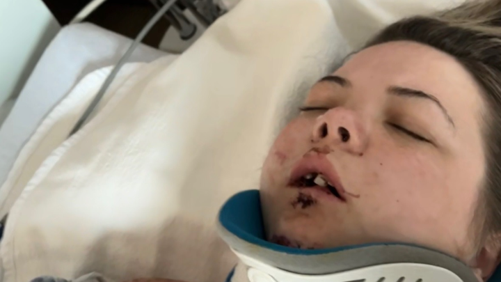 Help Kylie heal after her terrible accident campaign photo, 1 of 4