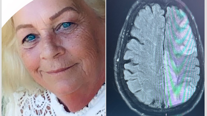 Help my mom’s stroke recovery process. campaign photo, 1 of 7