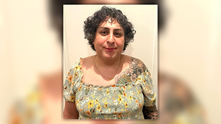 Support Setareh’s Facial Feminization Surgery & Recovery campaign photo, 1 of 3