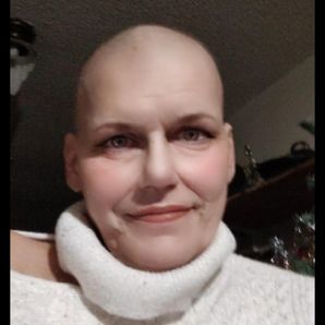 HELP REBECCA GET HER CHEST BK. TO NORMAL, SO SHE MAY HAVE RESTORATION SURGERY & CONFIDENCE BACK!