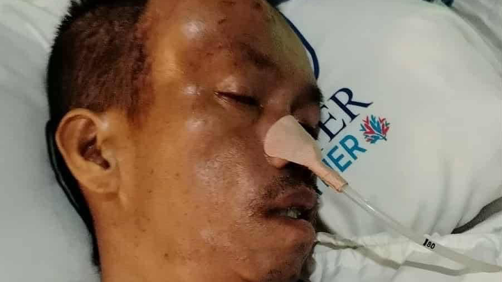 Villamor Pahinag (Buldog) medical expenses campaign photo, 1 of 6