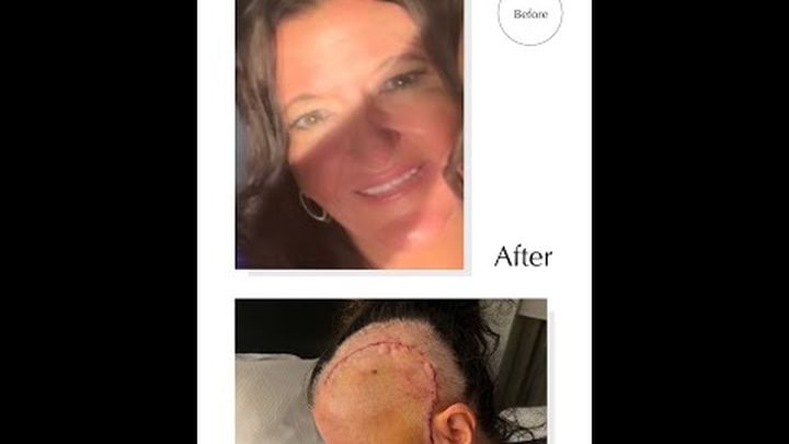 Help Us Heal: A Family’s Journey Through Recovery. video thumbnail, 1 of 3