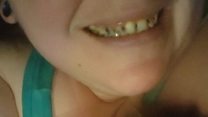 Support Needed for Life-Changing Dentures campaign photo, 1 of 5