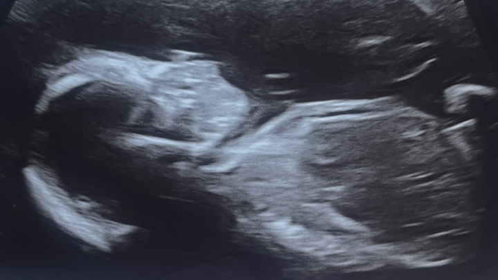 Insurance Denies Pregnant Wife campaign photo, 1 of 4