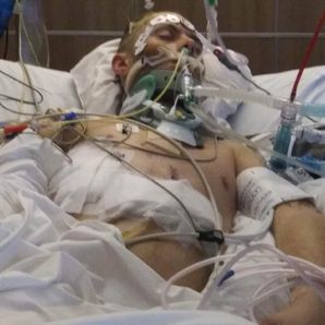 Danny motorcycle accident victim