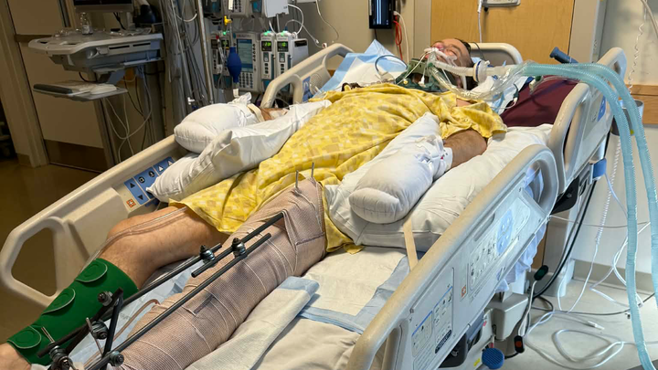 Support David’s Recovery After Tragic Accident campaign photo, 1 of 3