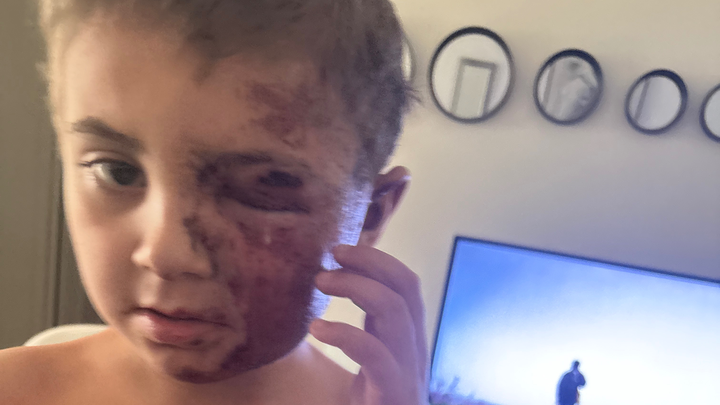 Help Amy & Valor Recover After Accident campaign photo, 1 of 8