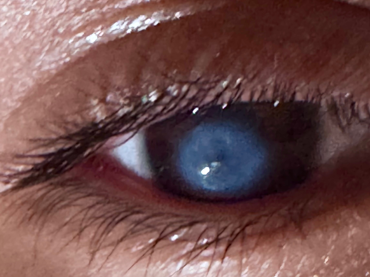 Family Plea: Restore Kevin's Eyesight campaign photo, 1 of 5