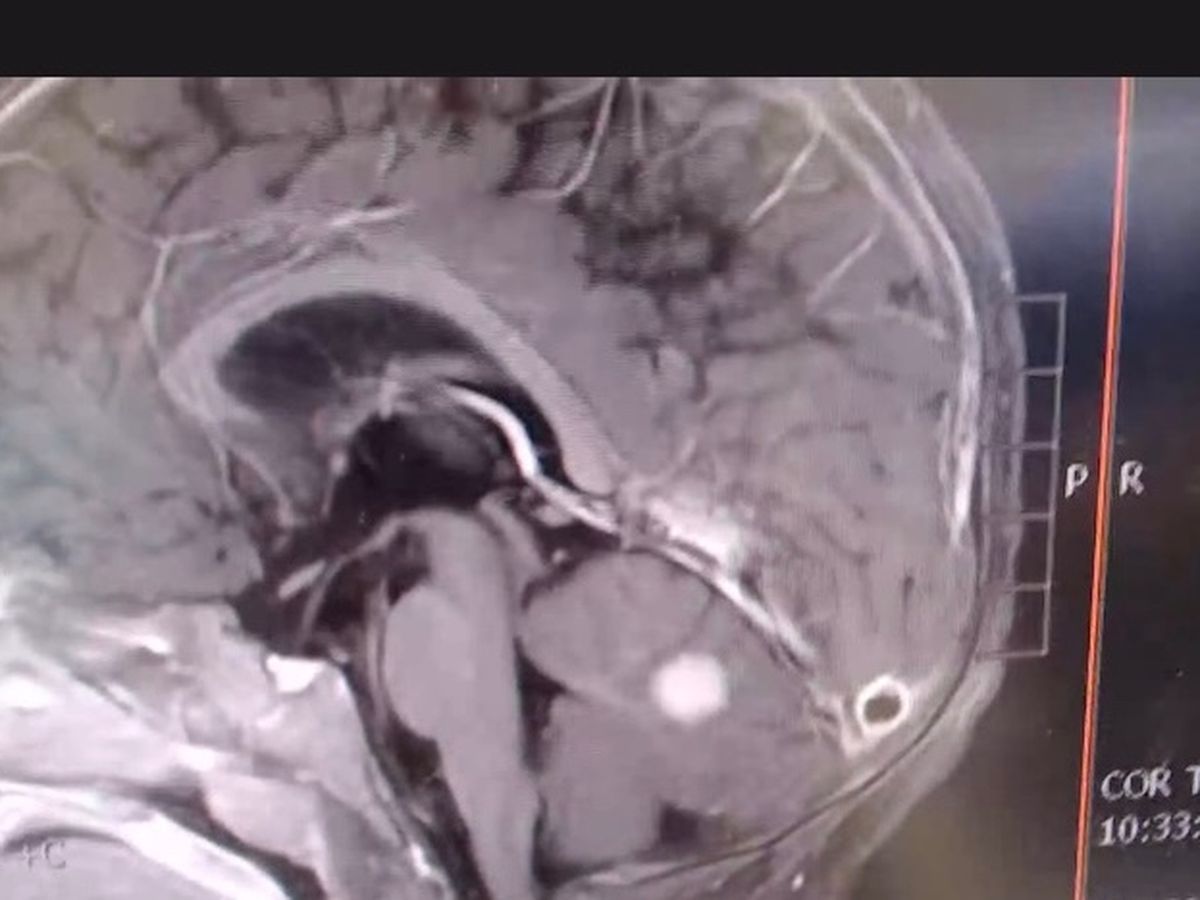 Support Asher’s Brain Surgery and Recovery campaign photo, 1 of 7