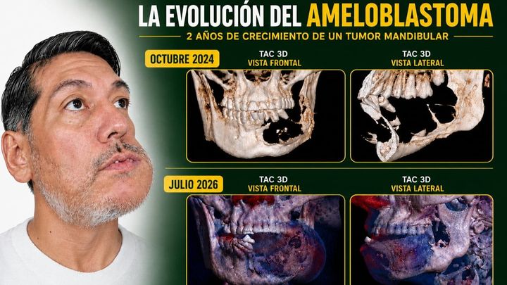 Ayuda a Hiram a Obtener la Cirugía que Necesita campaign photo, 1 of 3