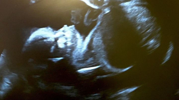 Foto principale della raccolta fondi