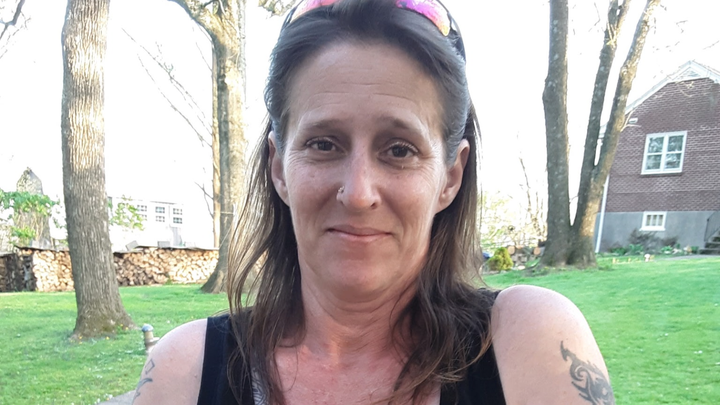 Restore My Sister's Smile and Health campaign photo, 1 of 4