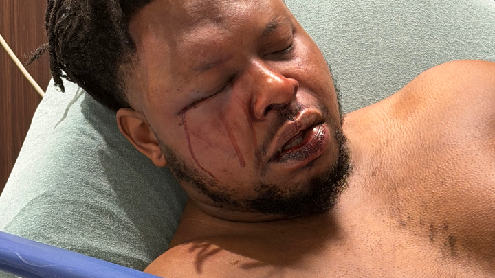 Justice and Healing for Malik After Hate Crime campaign photo, 1 of 5
