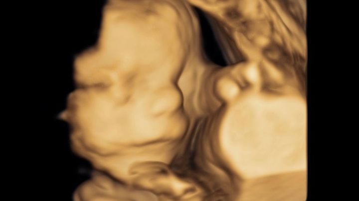 Support Baby Saelya’s Rare Journey campaign photo, 1 of 7