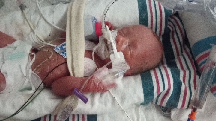 baby born 7 months premature