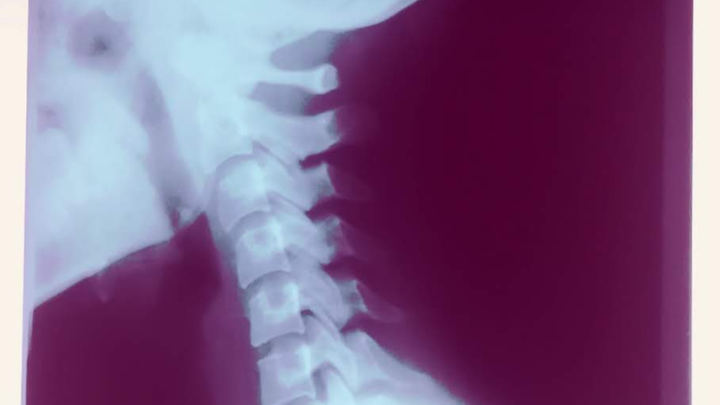 Help Anna Parsell-Wasik Overcome Medical Struggles campaign photo, 1 of 5