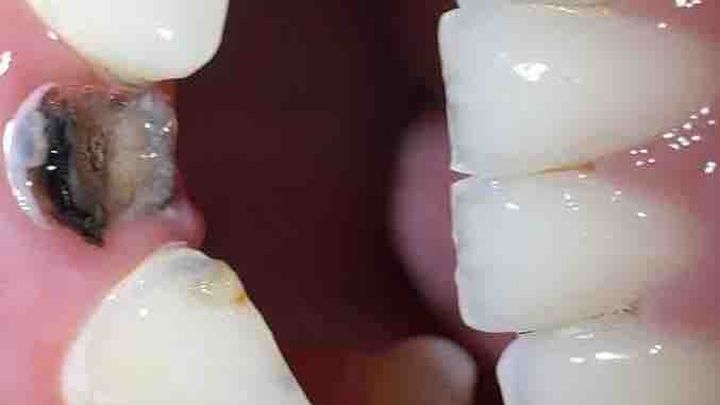 Restore my teeth campaign photo, 1 of 8