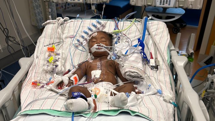 Nami’s Heart Surgery Recovery Fund campaign photo, 1 of 3