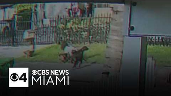 Help Ashley Recover from a Traumatic Dog Attack video thumbnail, 1 of 7