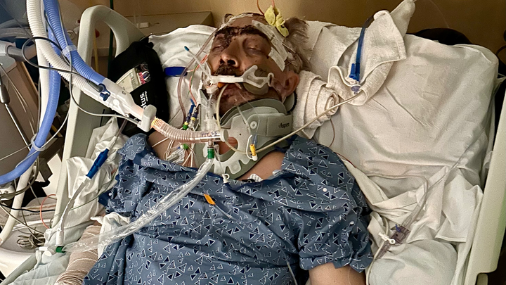 Help Our Loving Dad Heal From Tragic Hit & Run Accident campaign photo, 1 of 4