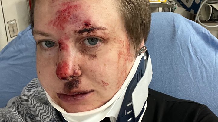 Recovering from a Scooter Accident campaign photo, 1 of 6