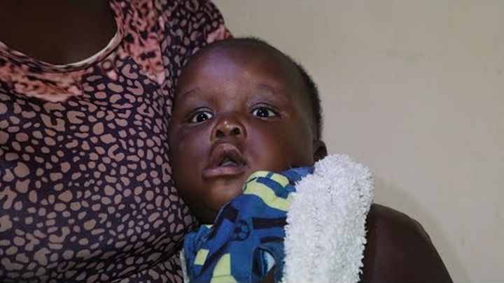 Protect Baby Matthew from permanent vision loss video thumbnail, 1 of 3