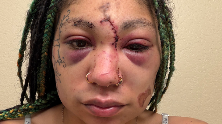 Survivor trying to survive campaign photo, 1 of 8