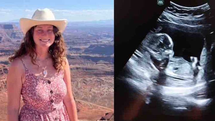 Support Heidi’s Birth & Baby Fund campaign photo, 1 of 5