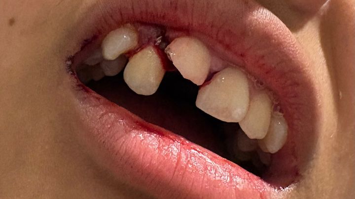 Support for Ana’s Daughter’s Urgent Dental Care campaign photo, 1 of 3
