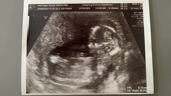 Donate to Ease Baby Tucker's Family's Burden campaign photo, 1 of 8