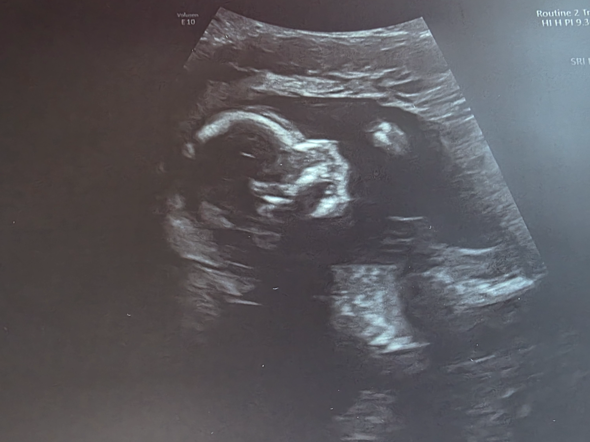 Help Cory & Brittanys Health Issues & Safety of Baby Boy campaign photo, 1 of 7