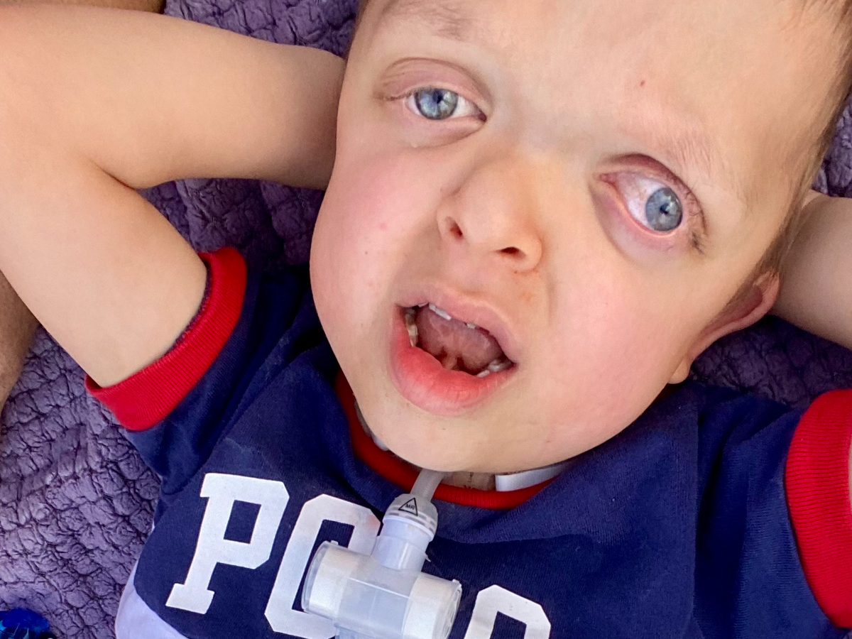 Help Mikey Get the Brain Surgery He Needs campaign photo, 1 of 4