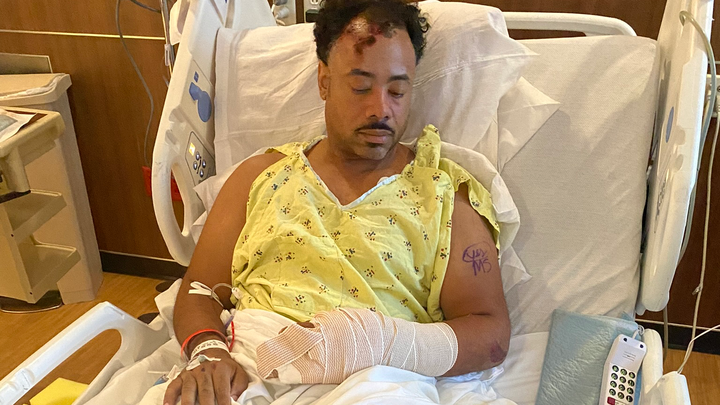 Help Firefighter Adam Hairston Recover campaign photo, 1 of 5