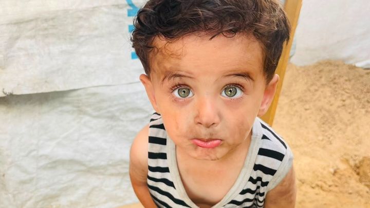 Help Nasser Get Treatment for Skin Disease and Start School campaign photo, 1 of 7