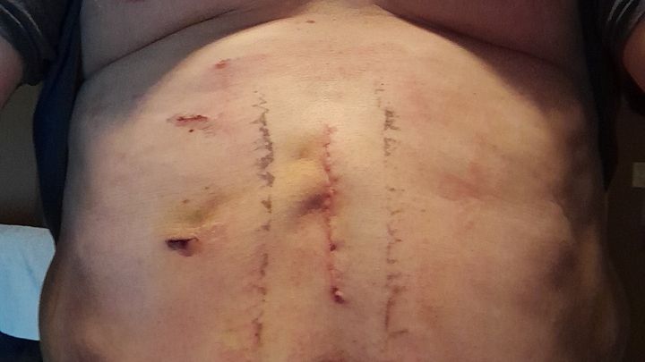 Support Navy Veteran's Cancer Surgery Costs campaign photo, 1 of 3