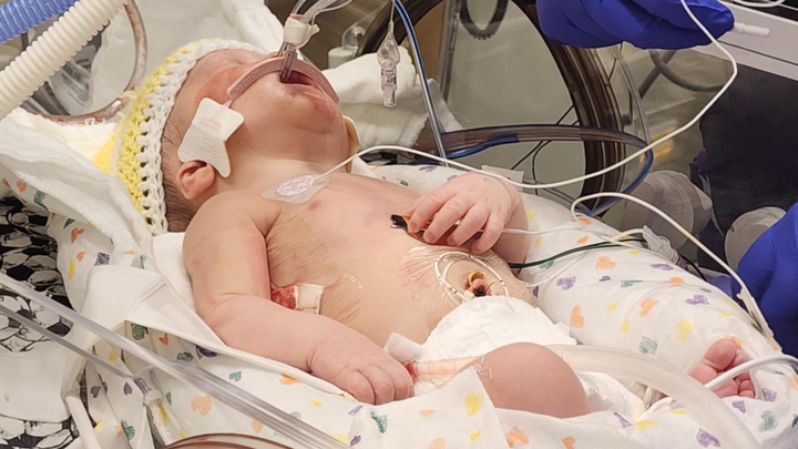 Baby Ro’s Nicu Journey campaign photo, 1 of 8