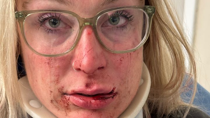 Help Celia Heal After Traumatic Attack campaign photo, 1 of 8