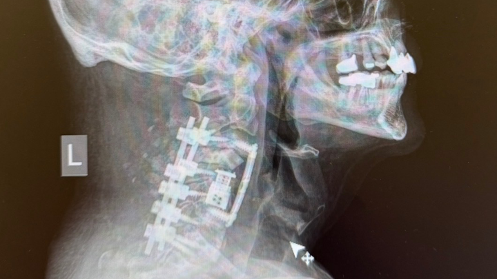 Support Randy’s Recovery & Medical Expenses campaign photo, 1 of 7