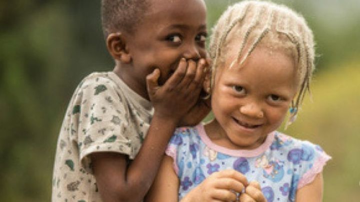 Fundraiser By Global Aid Missions Keep Zimbabwe S Only Albinism Clinic Open